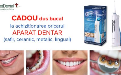 aparat dentar