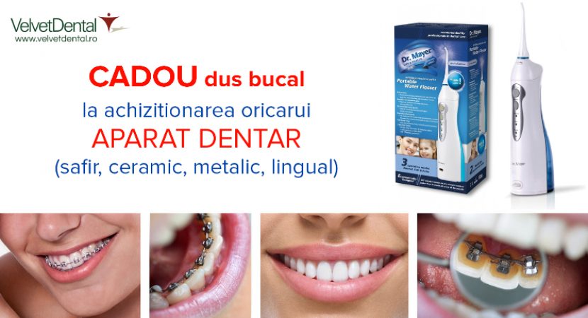 aparat dentar