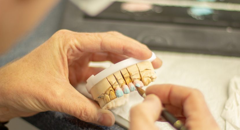 avantaje coroane dentare