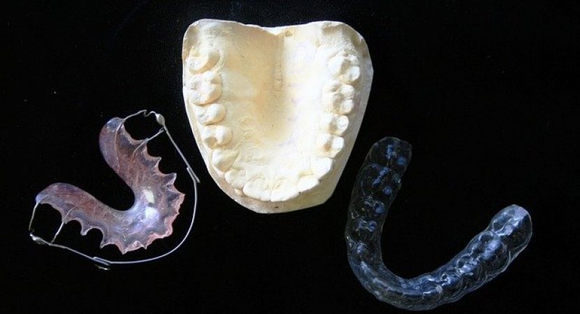 inserare implant dentar