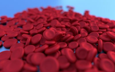 Anemia